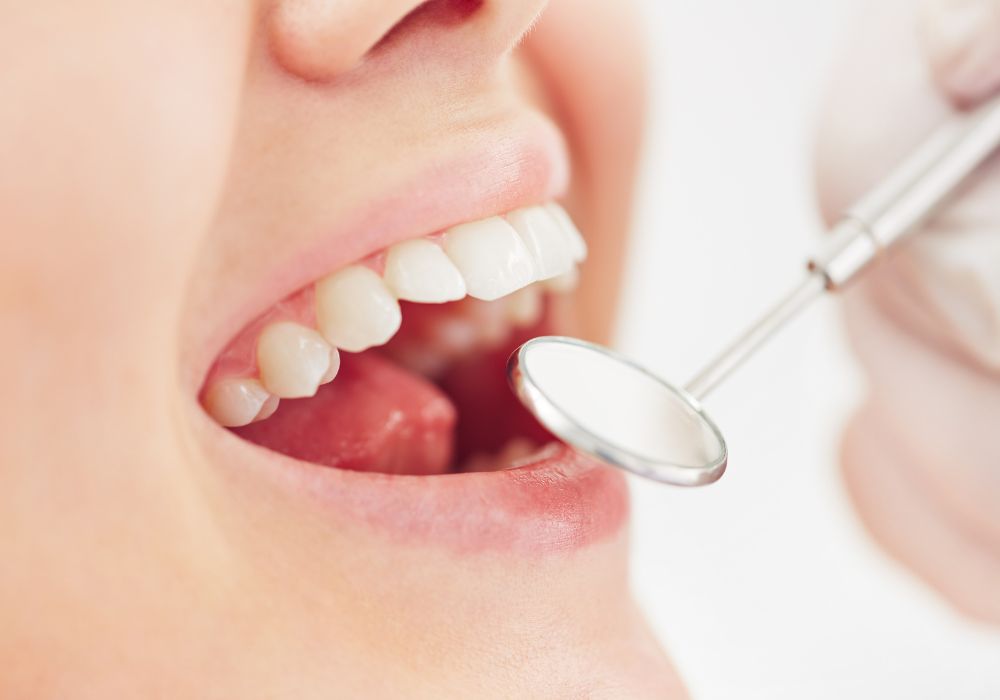 Understanding Tooth Transparency