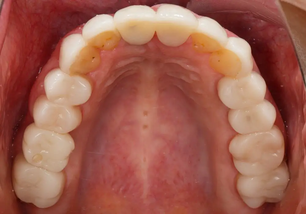 Unique Growth Pattern for Upper Jaw and Teeth