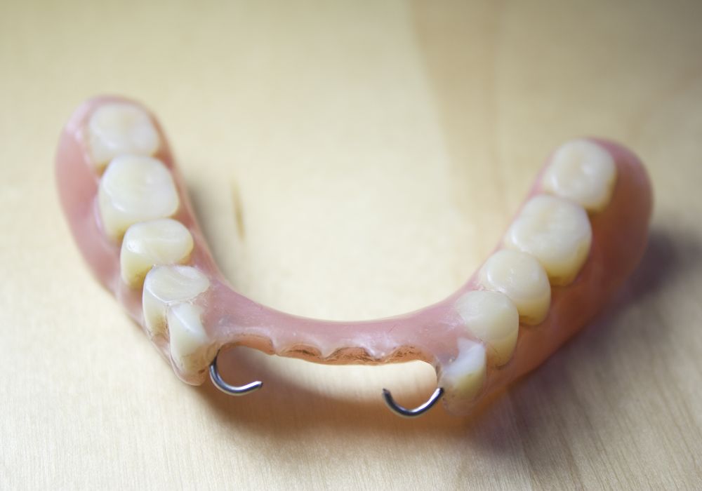 Using technology to identify dental prosthetics