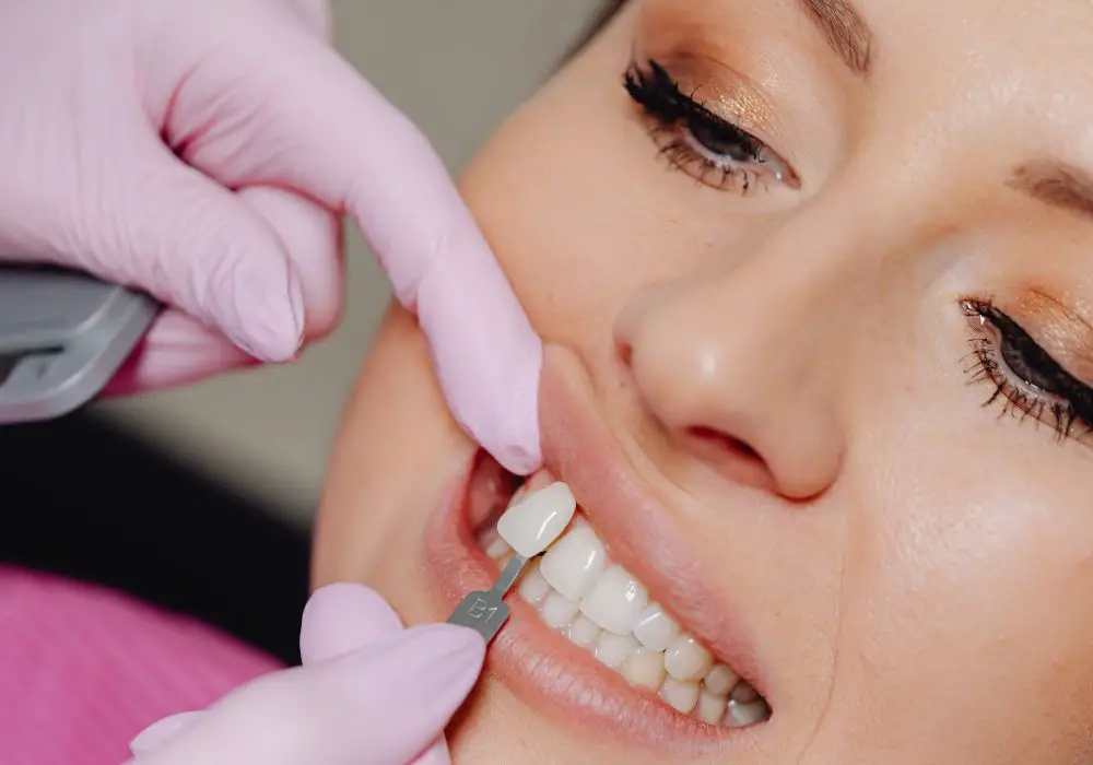 Veneers and Teeth Lengthening