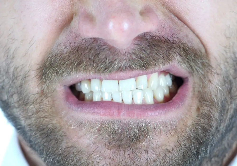 What Causes Teeth Grinding?