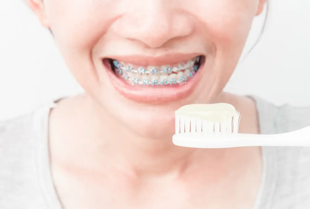 Captivating Can You Use Whitening Toothpaste With Braces Image in 4K Captivating Can You Use Whitening Toothpaste With Braces Image in 4K