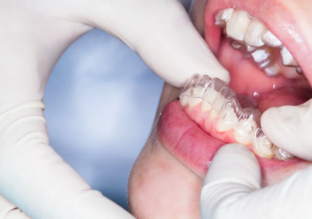 What Treatment Options Can Stop Tooth Movement?