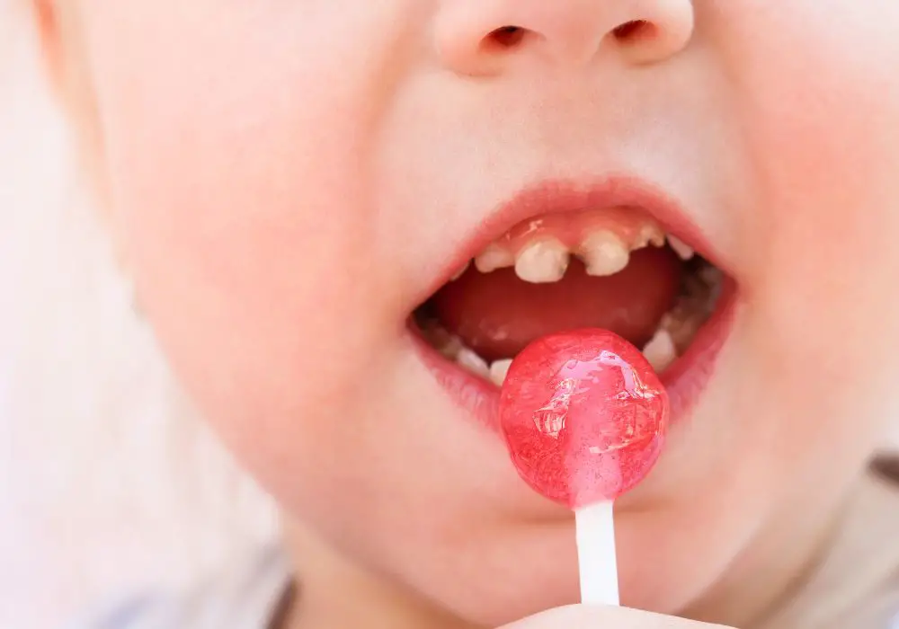 What are signs of seriously decayed baby teeth