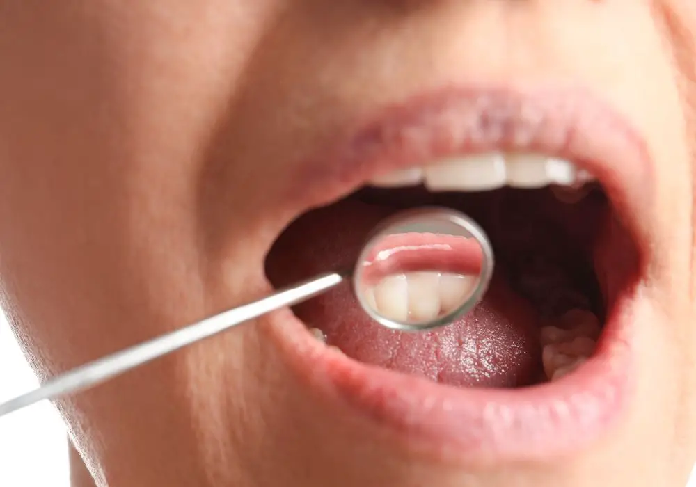 What are the symptoms of receding gums?