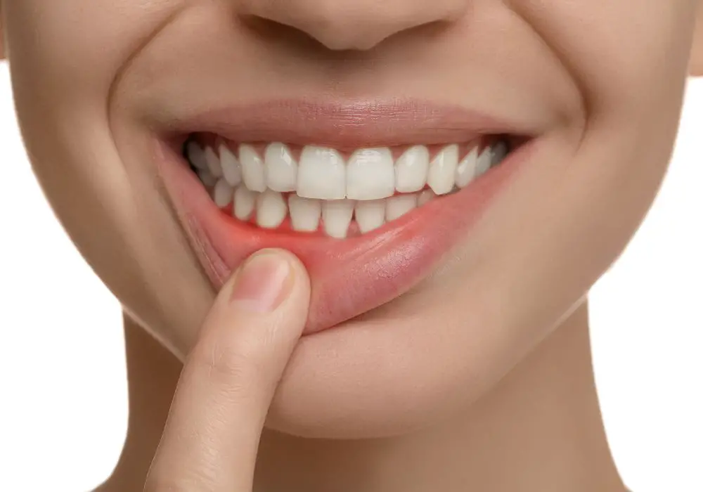 What are the treatment options for receding gums?