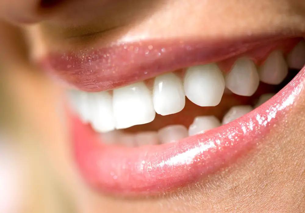 What causes pointed teeth