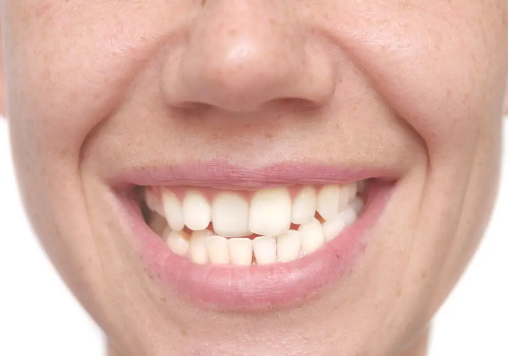 What causes teeth to shift quickly on their own