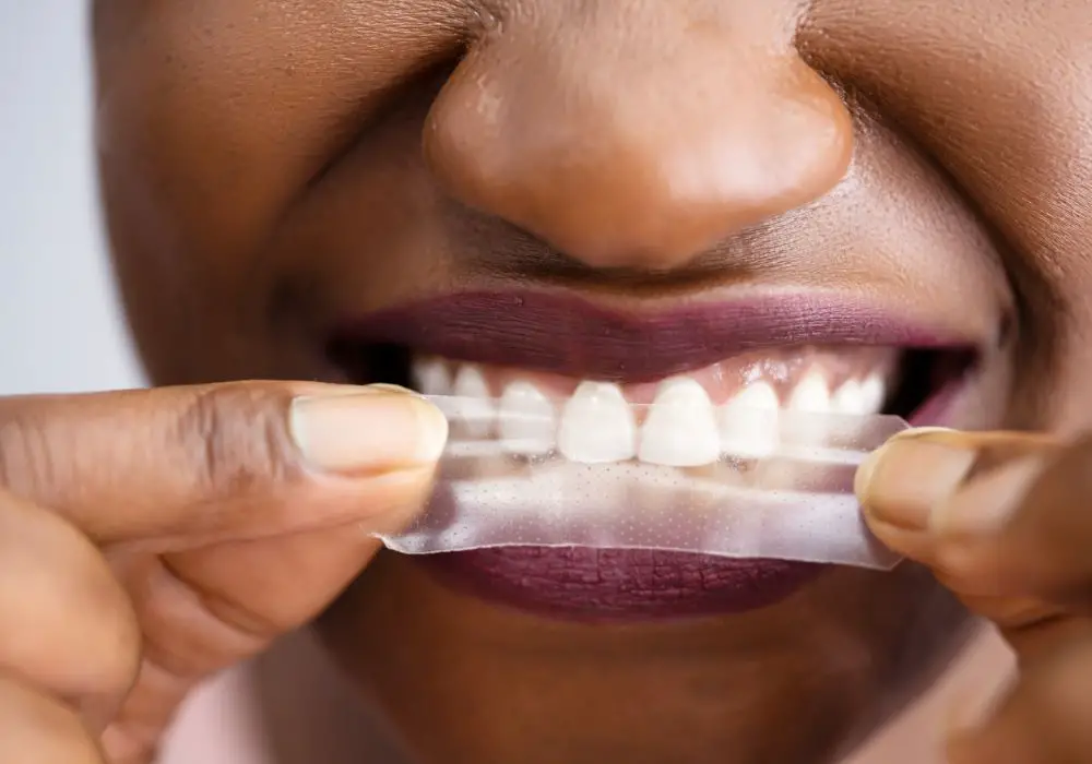 What causes tooth whitening products expire