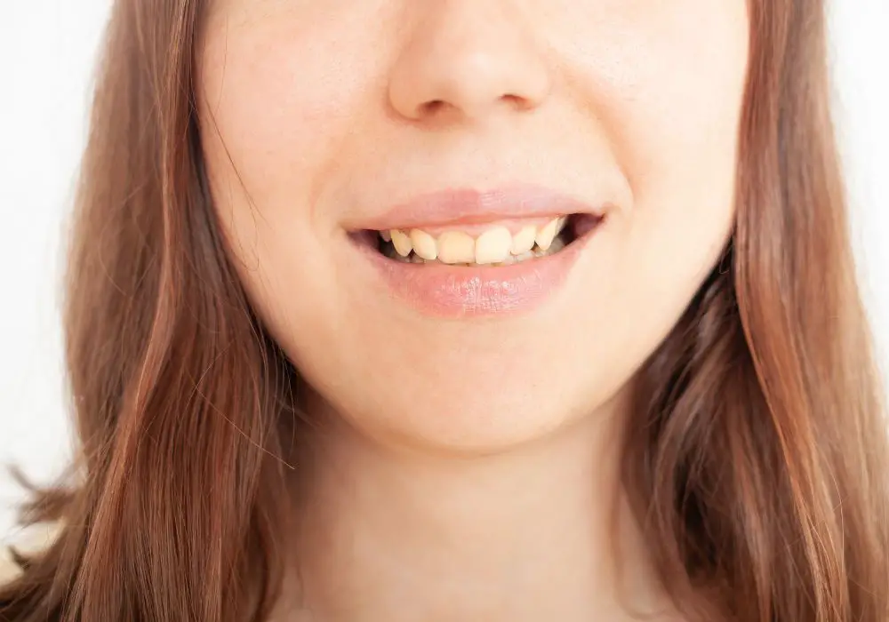 What factors promote plaque buildup and gum disease