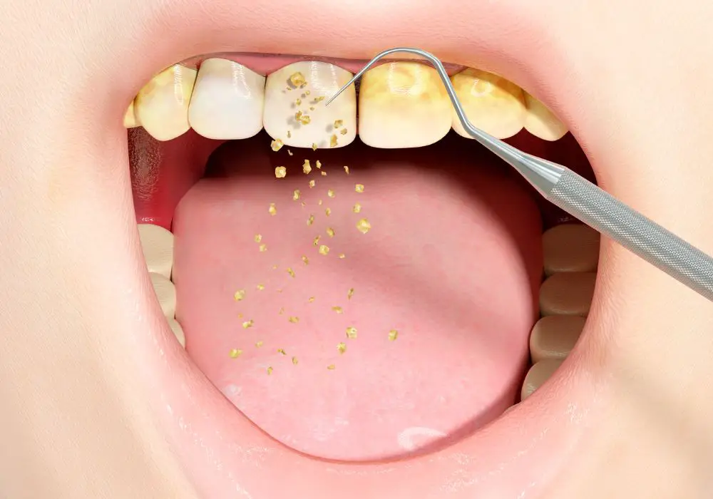 What foods help clean plaque off teeth?
