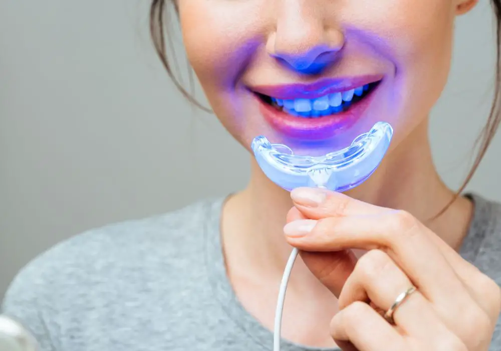 What is Home Teeth Whitening