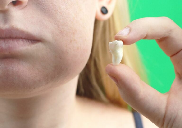 What Makes Wisdom Teeth Swelling Go away?