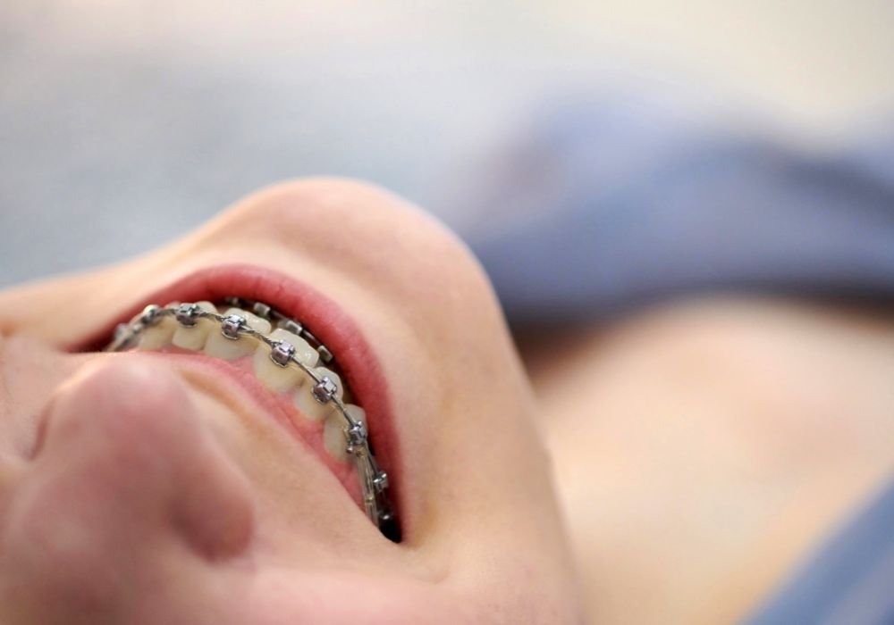 What problems can bruxism and malocclusion lead to?
