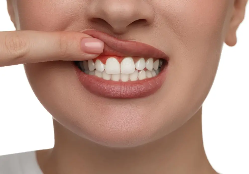 What problems can overgrown gums cause