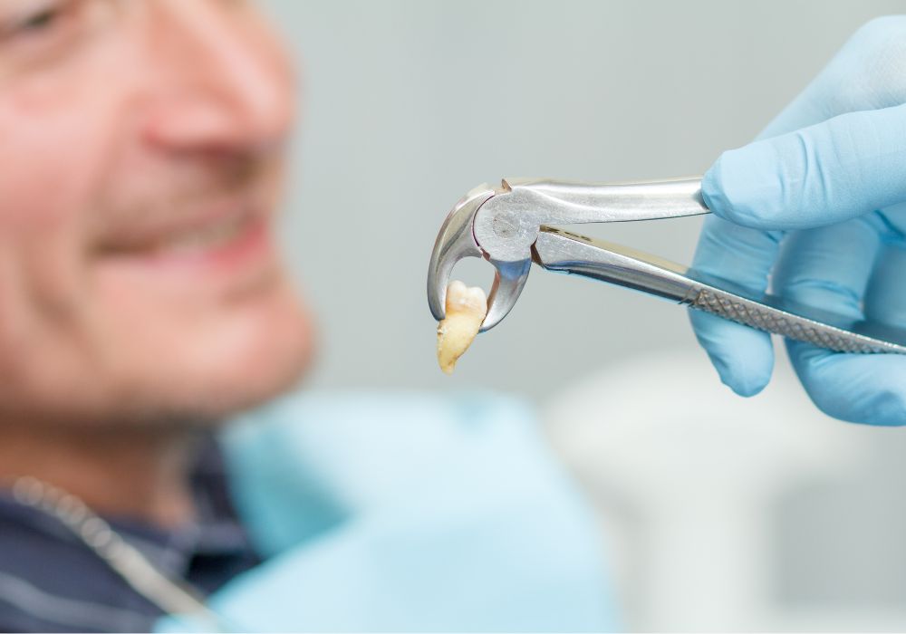 Stunning When Can I Eat Meat After Wisdom Teeth Removal Image Digital Art Stunning When Can I Eat Meat After Wisdom Teeth Removal Image Digital Art