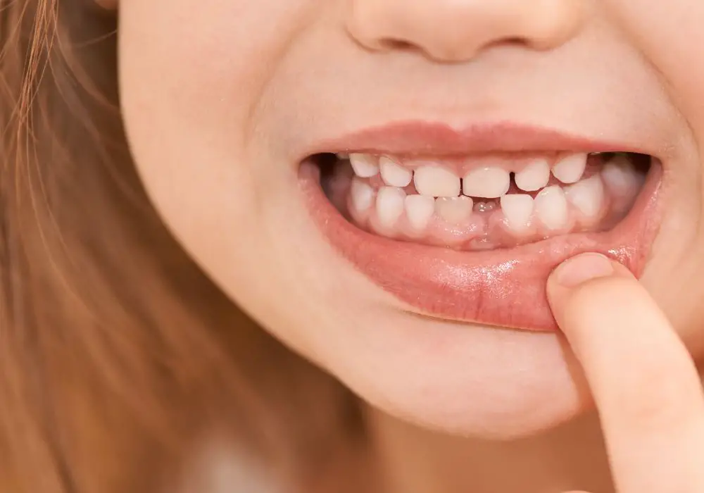 When Permanent Teeth Get Loose?