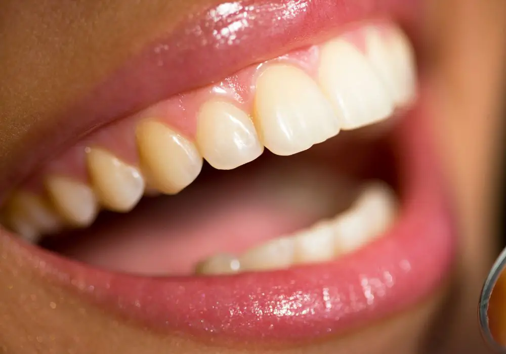 When are the upper teeth normally visible?