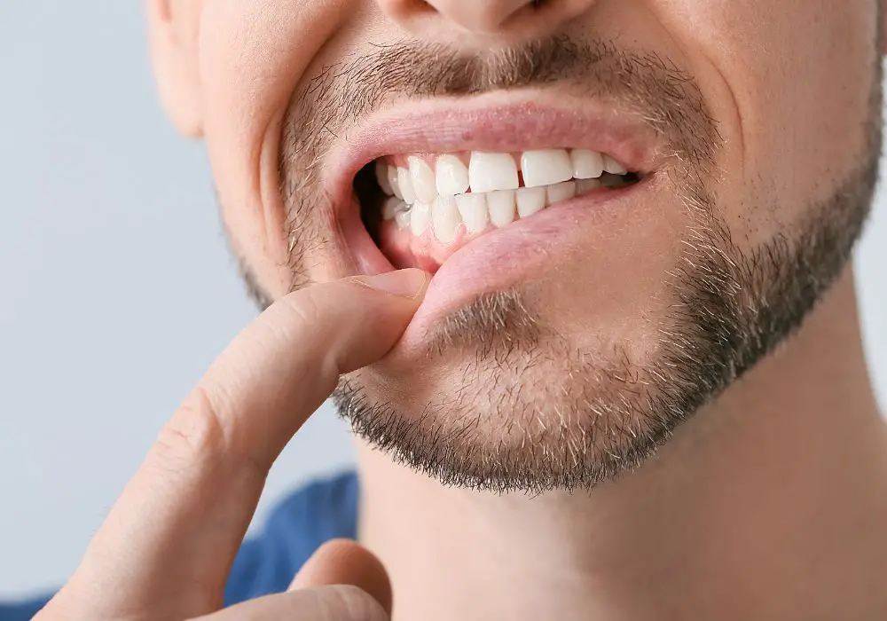 When to See a Dentist About Jogging Gum Discomfort?