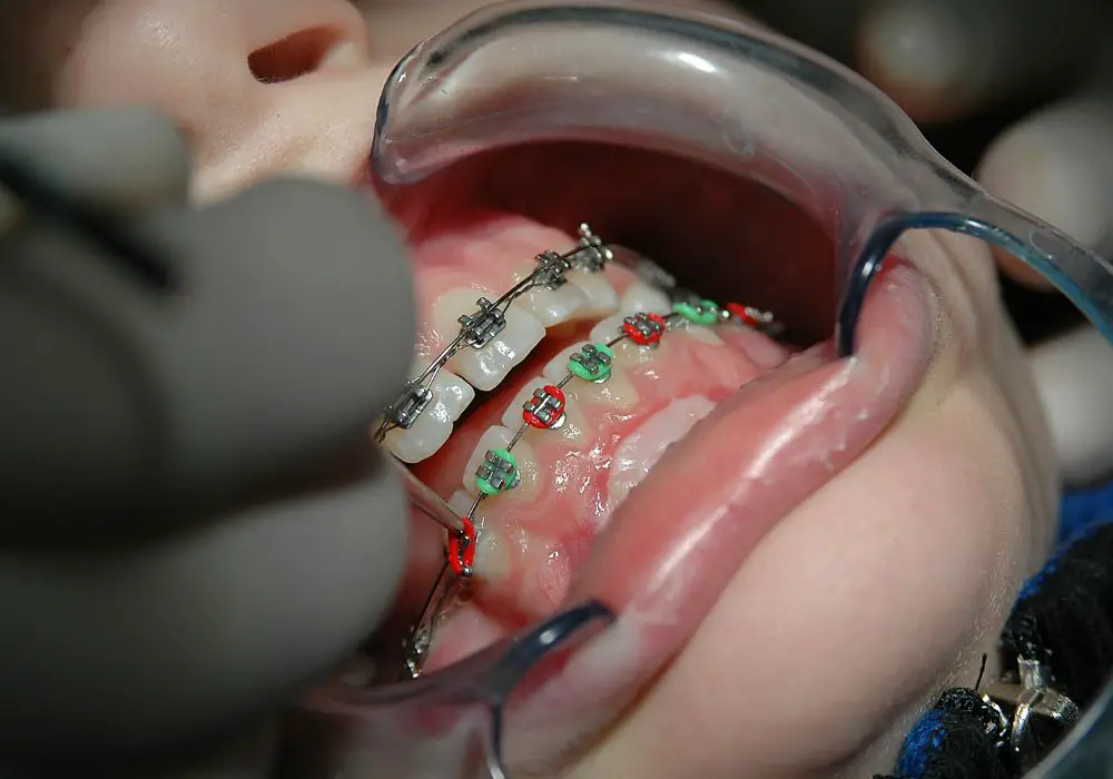 When to call the orthodontist