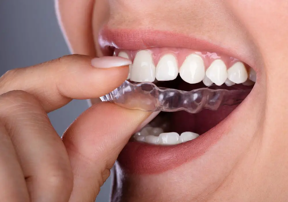 Who Is at Higher Risk of Tooth Loss with Aligners