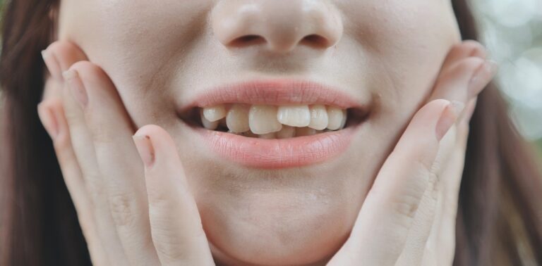 Why Are Crooked Teeth Attractive In Japan? (Origins, Culture & Worldview)