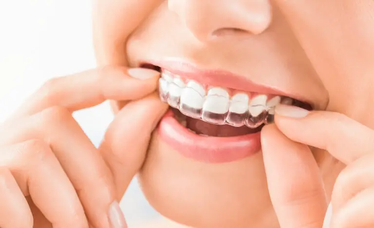 Why Are My Teeth Loose After Invisalign? (Causes & Tips)