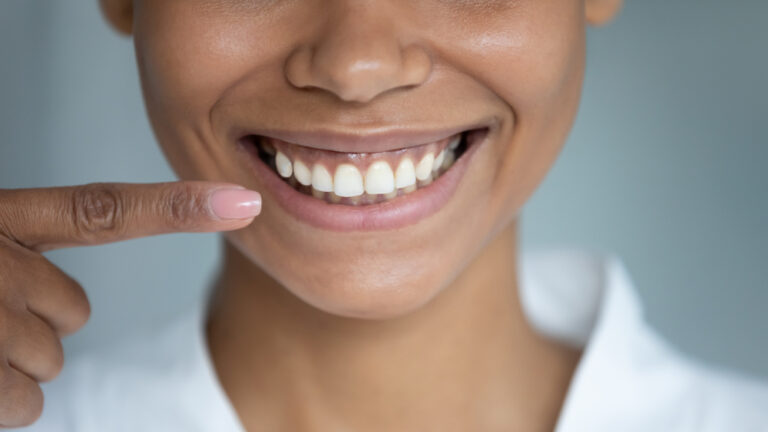 Why Are My Teeth Turning Black Near My Gums? (Find Out the Causes)