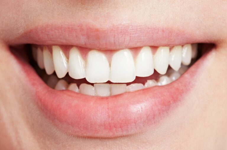 Why Are Some People’s Teeth Naturally Whiter? Discover the Science Behind Bright Smiles