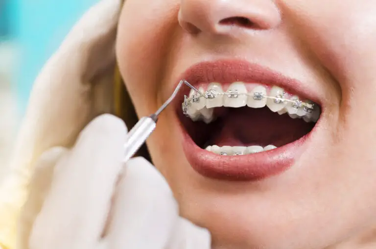 Why Do All My Teeth Hurt After Braces? (An In-Depth Guide)