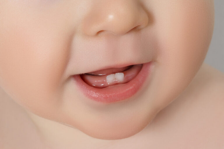 Why Do Baby Teeth Take So Long To Come In? (Symptoms and Remedies)