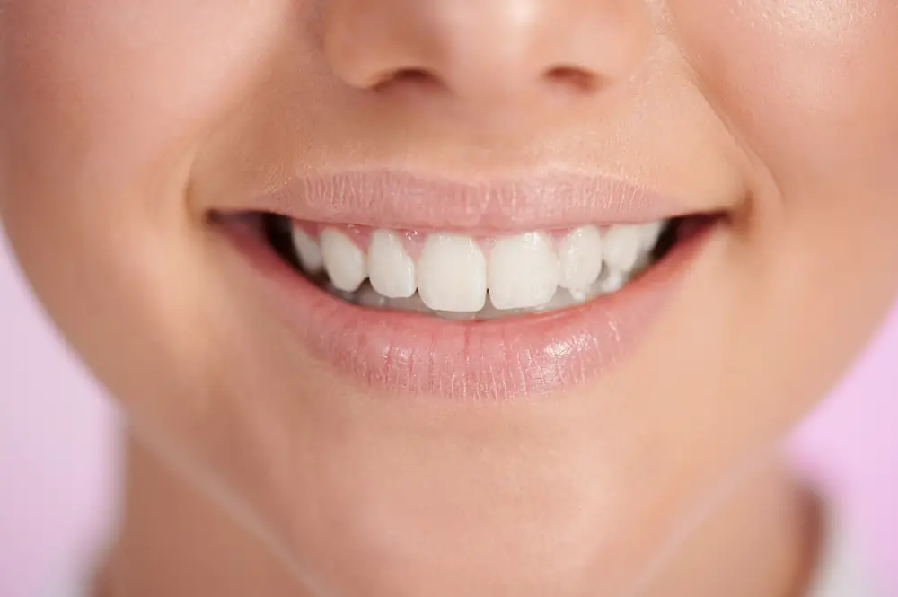 Why Do My Front Teeth Still Have Ridges? Understanding the Causes and
