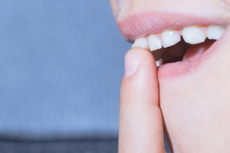 Why Do My Teeth Feel Loose But Not Wobbly? (Causes & Caring Tips)