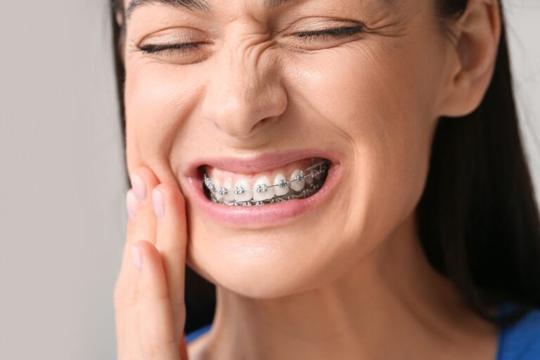 Why Do My Teeth Hurt So Much With Braces? (Reasons & Tips)