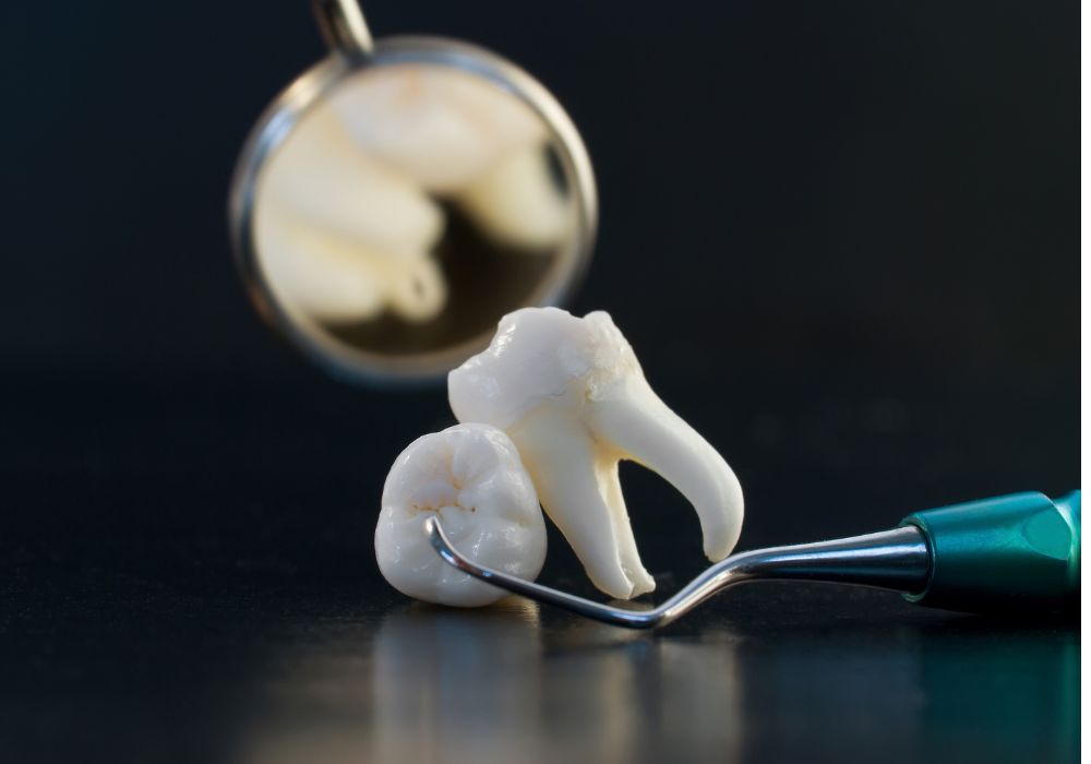 Why Wisdom Teeth Affect Models?