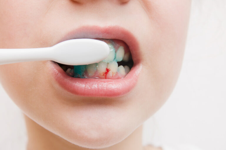 Why Did Blood Come Out From A Teeth? (Causes & Treatment)