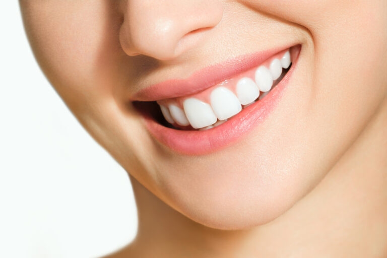 tom cruise first teeth Why Do Americans Have Perfect Teeth? (Major Factors Explained)