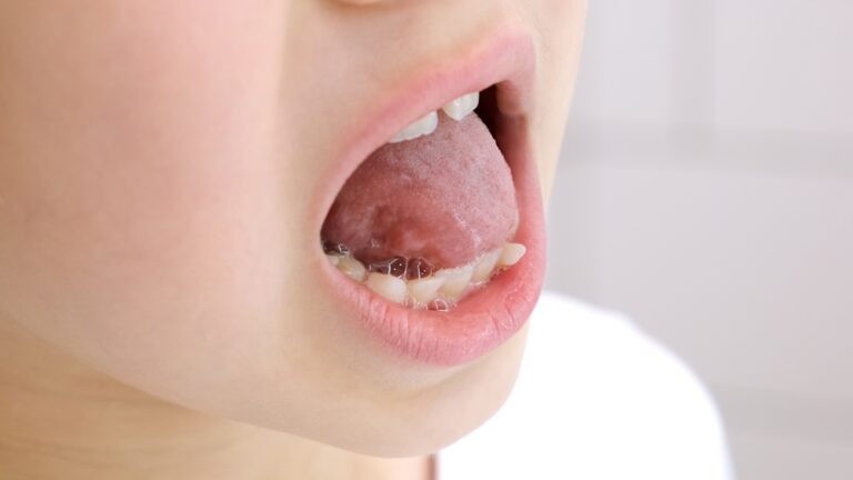 Why do I keep pressing my tongue against my bottom teeth?