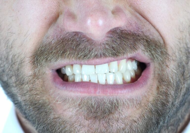 Why Do My Teeth Chatter Sometimes? (Causes & Risks)