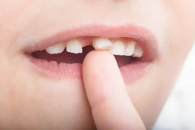 Why Do My Teeth Feel Loose Sometimes? (Causes & Treatment)
