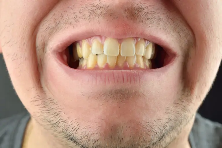 Why Does Coffee Make My Teeth Yellow? (How To Treat & Prevent Stains)