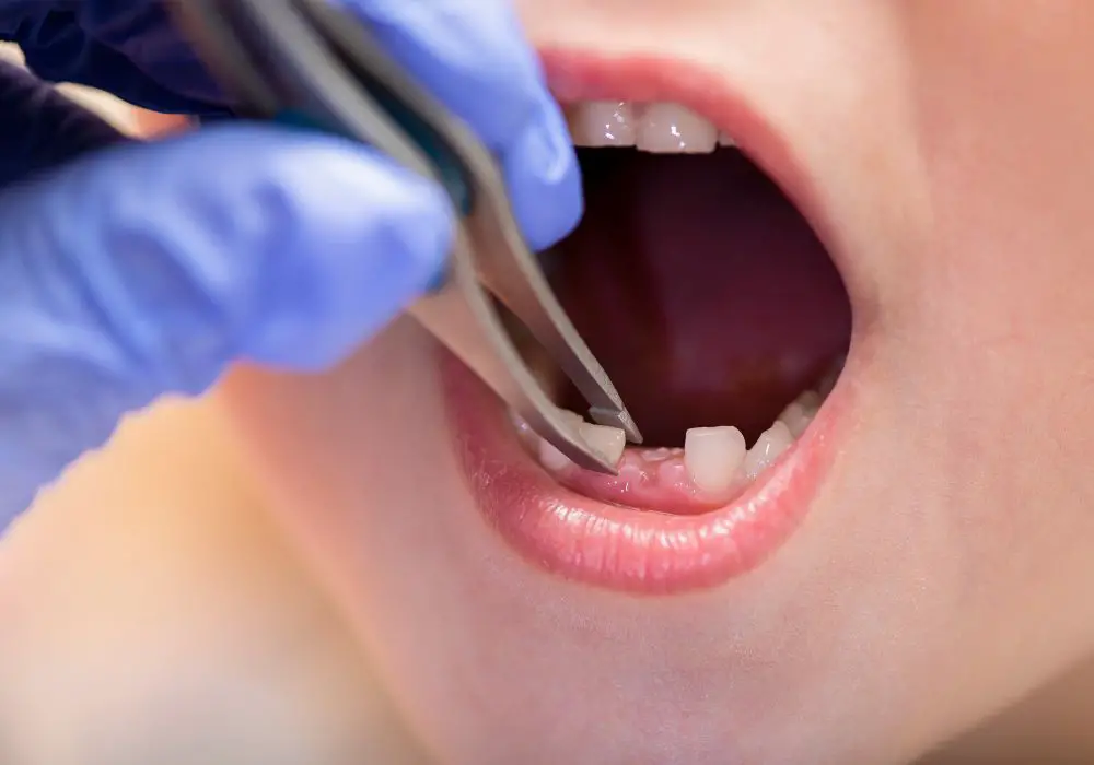 Why families choose to bury baby teeth today?