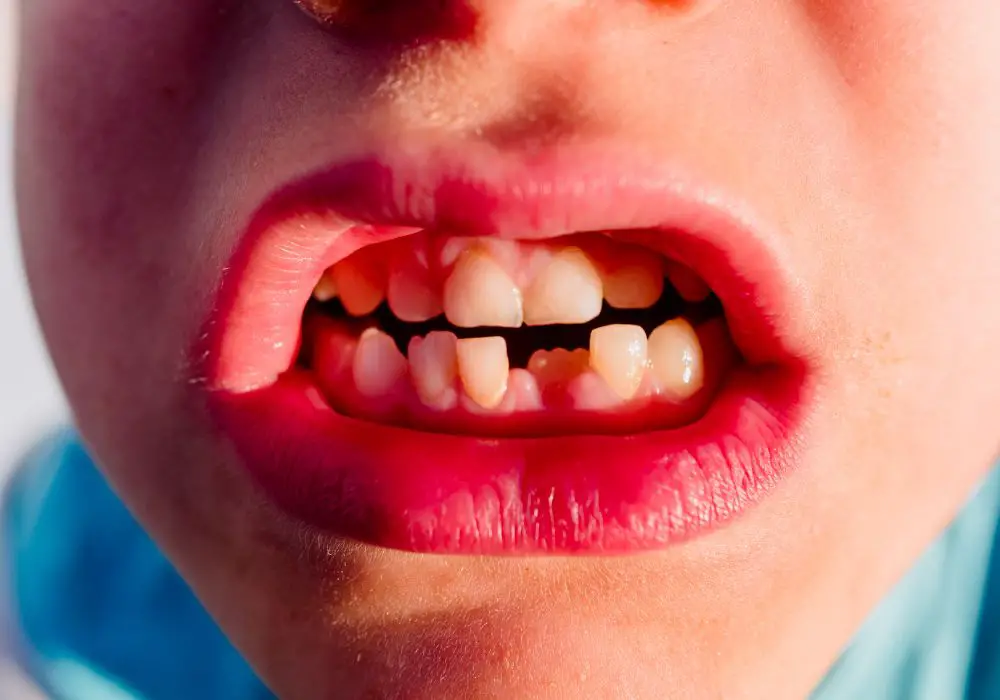 Why front teeth feel jagged: Key takeaways