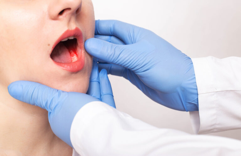 Why Is My Wisdom Tooth Bleeding A Lot? (Causes & Risks)
