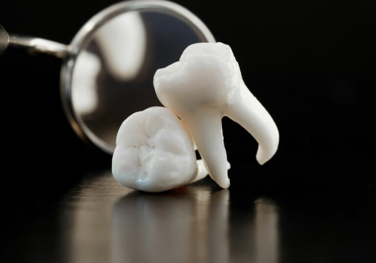 Why shouldn’t you eat before wisdom teeth removal? (Everything You Need To Know)