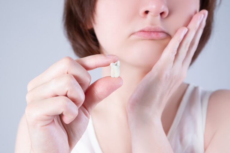Understanding Wisdom Teeth: Which Teeth are They and Why?