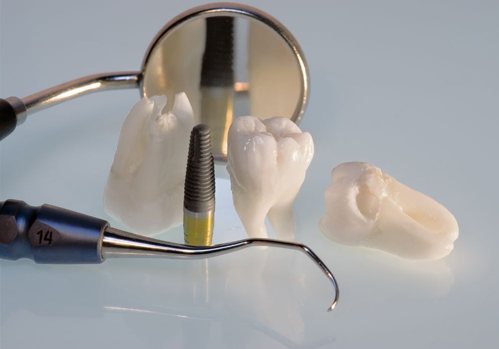 Wisdom Teeth Extraction Process