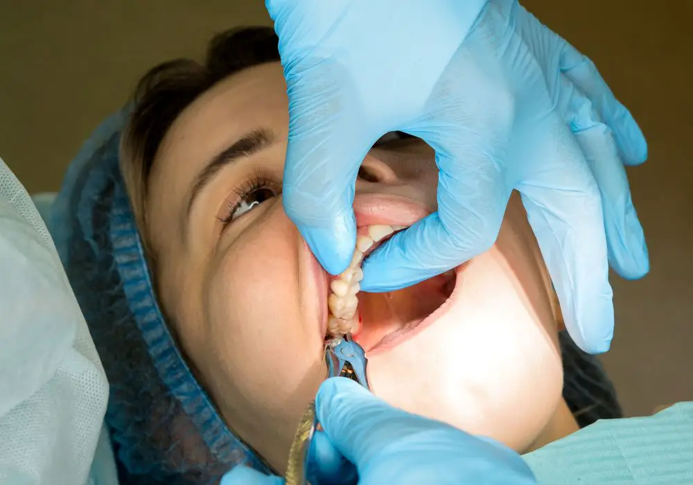 Wisdom tooth extraction procedures