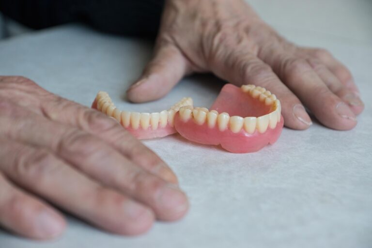 Can I make my own false teeth? (Step-by-step process)