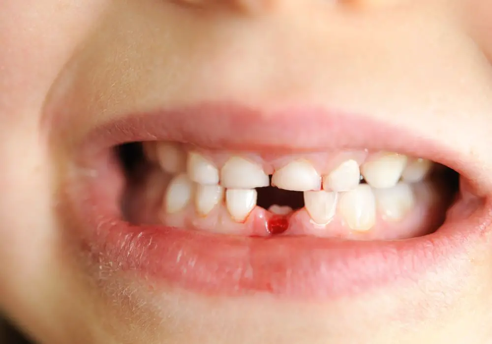 conduct a baby tooth burial ceremony at home